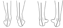 Pronation och supination